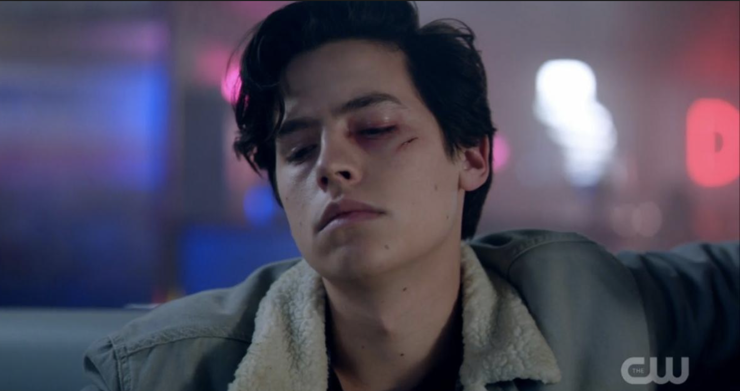 Riverdale : comment Cole Sprouse et Charles Melton se sont blessés sur le tournage